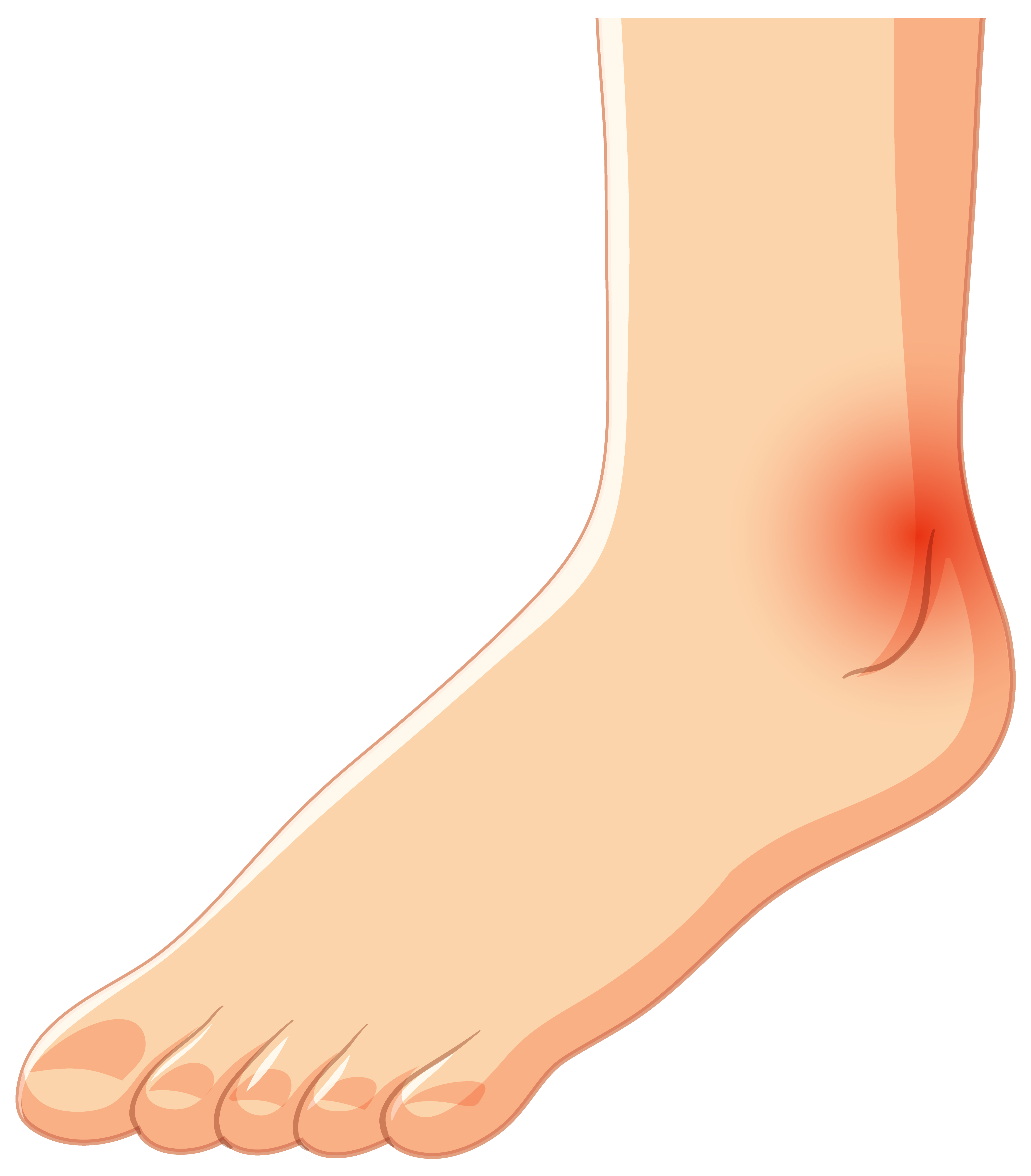 Preventing Falls and Ankle Sprains During Hajj