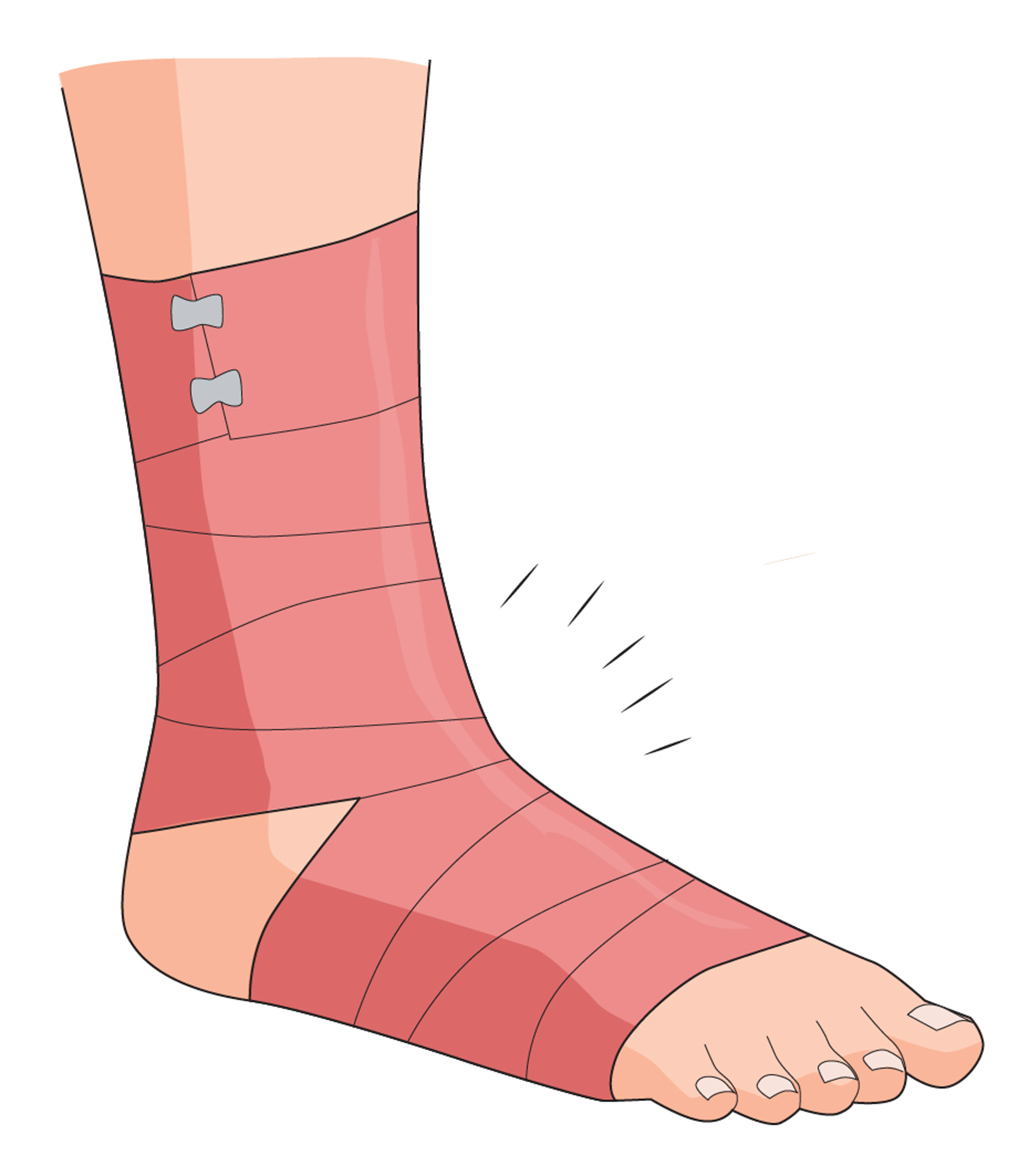Managing Bruises During Hajj 